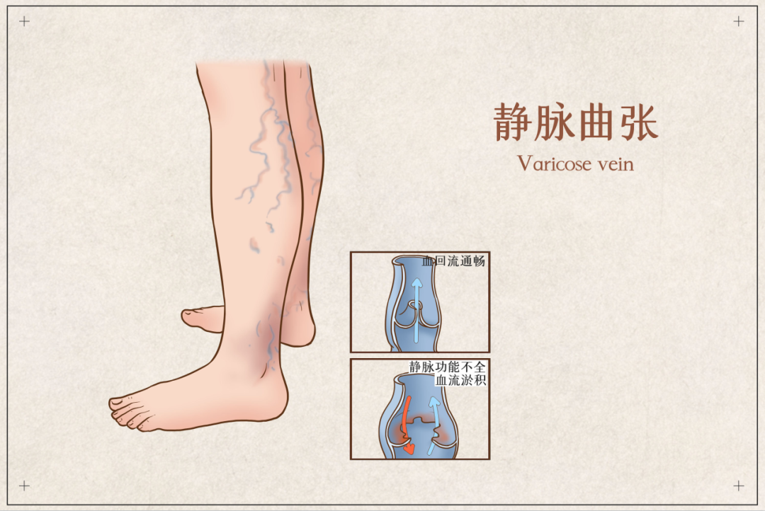 茶葉批發(fā)丨養(yǎng)生茶丨艾條的作用丨艾灸養(yǎng)生