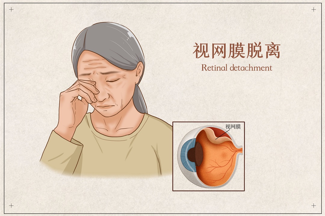 茶葉批發(fā)丨養(yǎng)生茶丨艾條的作用丨艾灸養(yǎng)生
