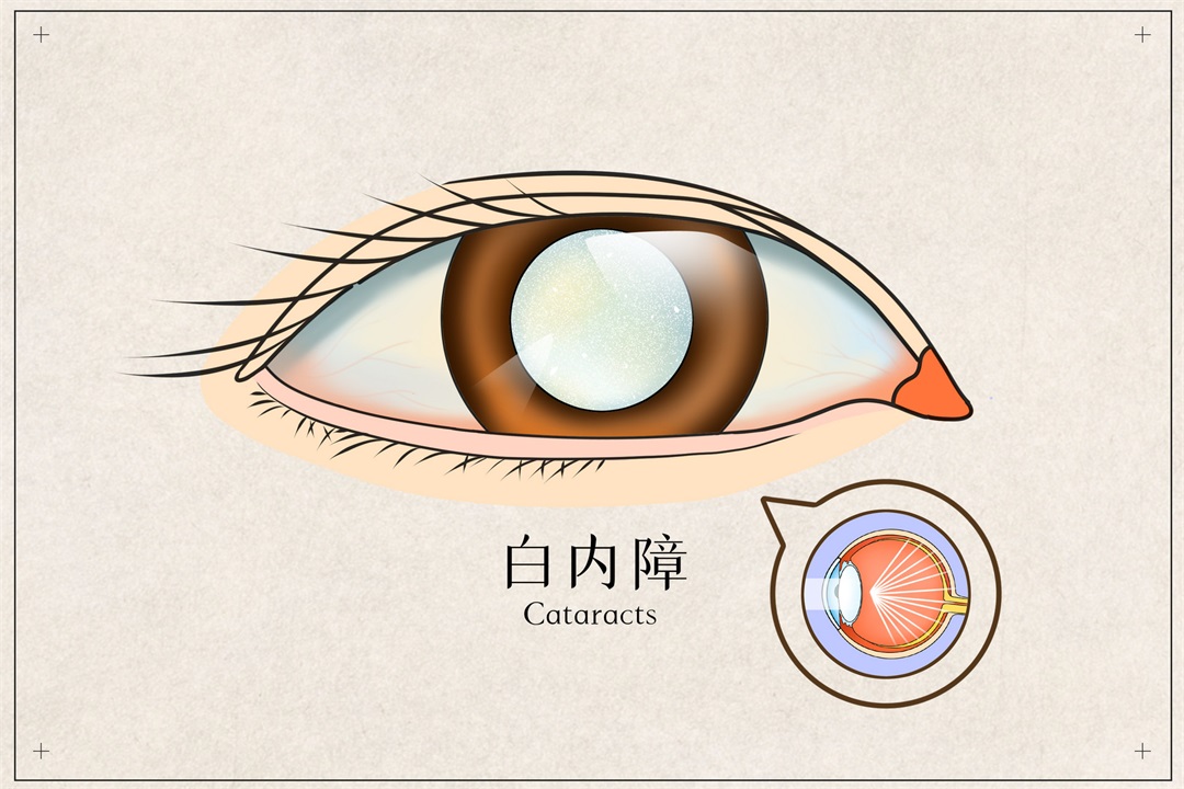 茶葉批發(fā)丨養(yǎng)生茶丨艾條的作用丨艾灸養(yǎng)生