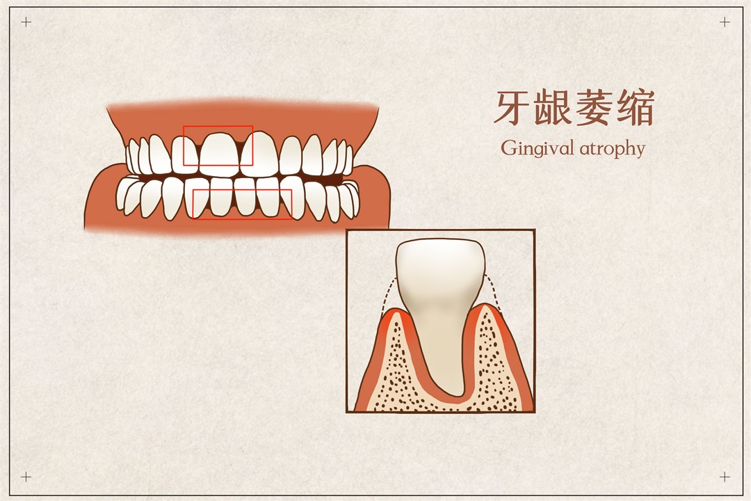 茶葉批發(fā)丨養(yǎng)生茶丨艾條的作用丨艾灸養(yǎng)生