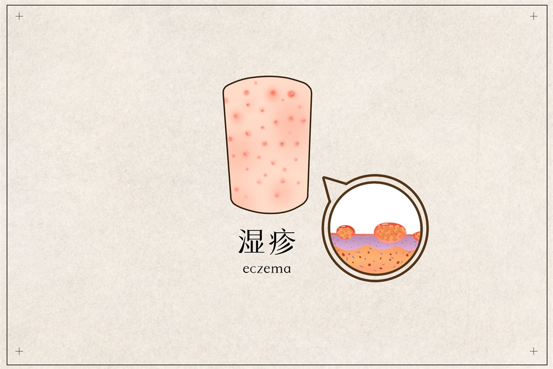 茶葉批發(fā)丨養(yǎng)生茶丨艾條的作用丨艾灸養(yǎng)生