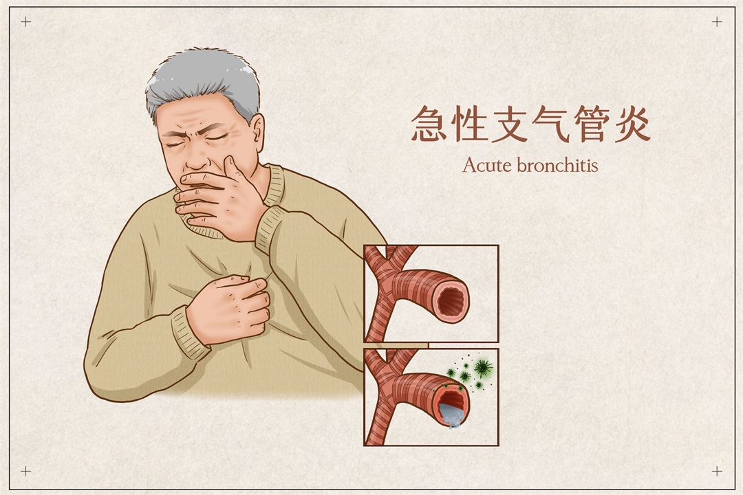 茶葉批發(fā)丨養(yǎng)生茶丨艾條的作用丨艾灸養(yǎng)生
