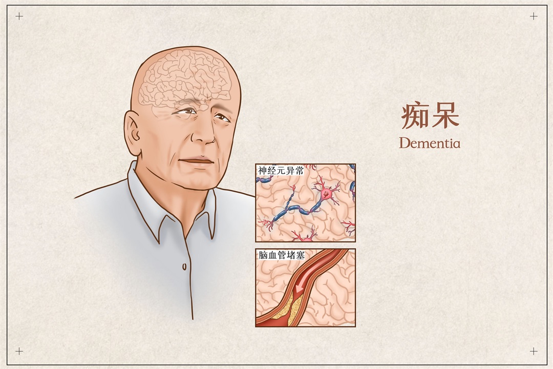 茶葉批發(fā)丨養(yǎng)生茶丨艾條的作用丨艾灸養(yǎng)生
