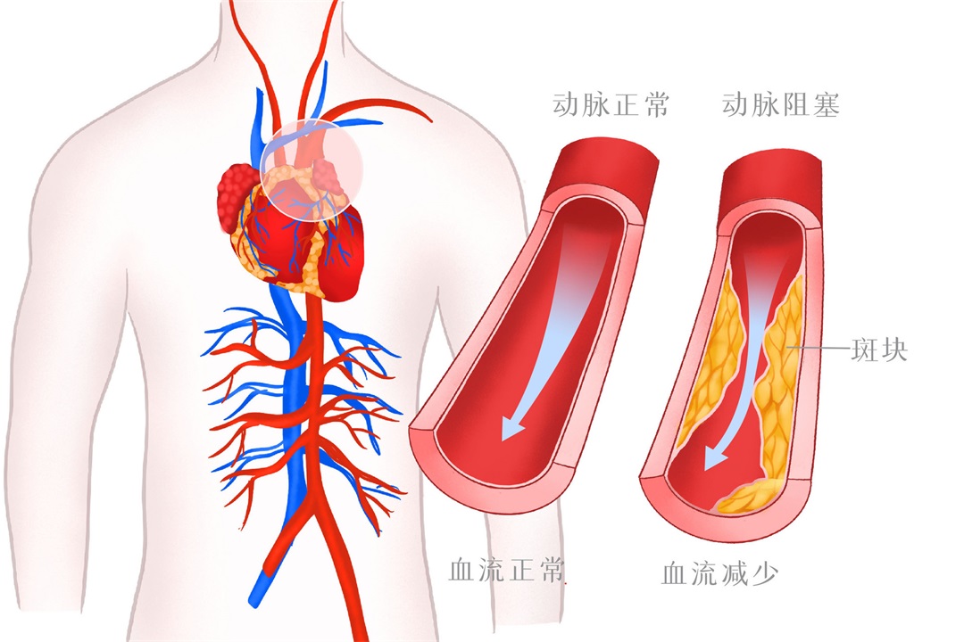 茶葉批發(fā)丨養(yǎng)生茶丨艾條的作用丨艾灸養(yǎng)生