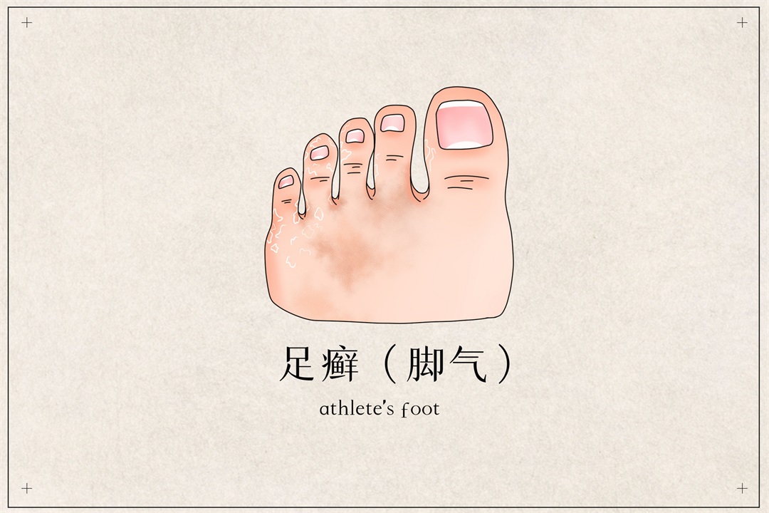 茶葉批發(fā)丨養(yǎng)生茶丨艾條的作用丨艾灸養(yǎng)生