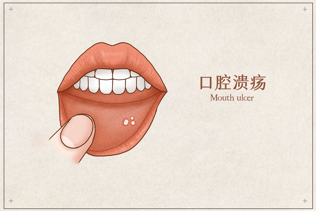茶葉批發(fā)丨養(yǎng)生茶丨艾條的作用丨艾灸養(yǎng)生