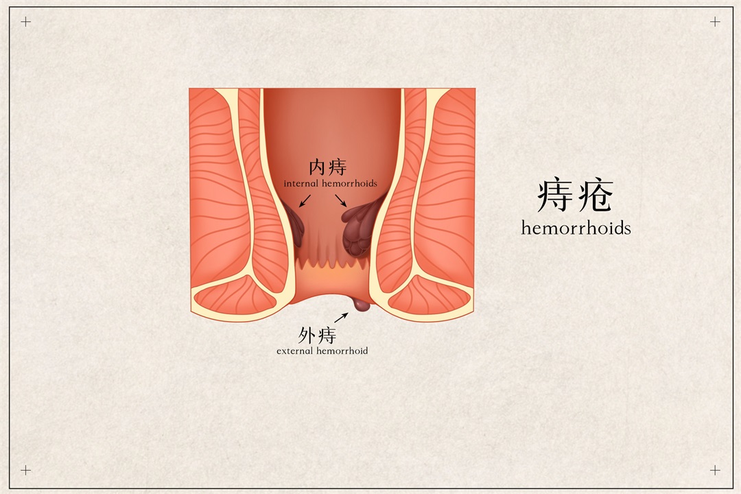 茶葉批發(fā)丨養(yǎng)生茶丨艾條的作用丨艾灸養(yǎng)生