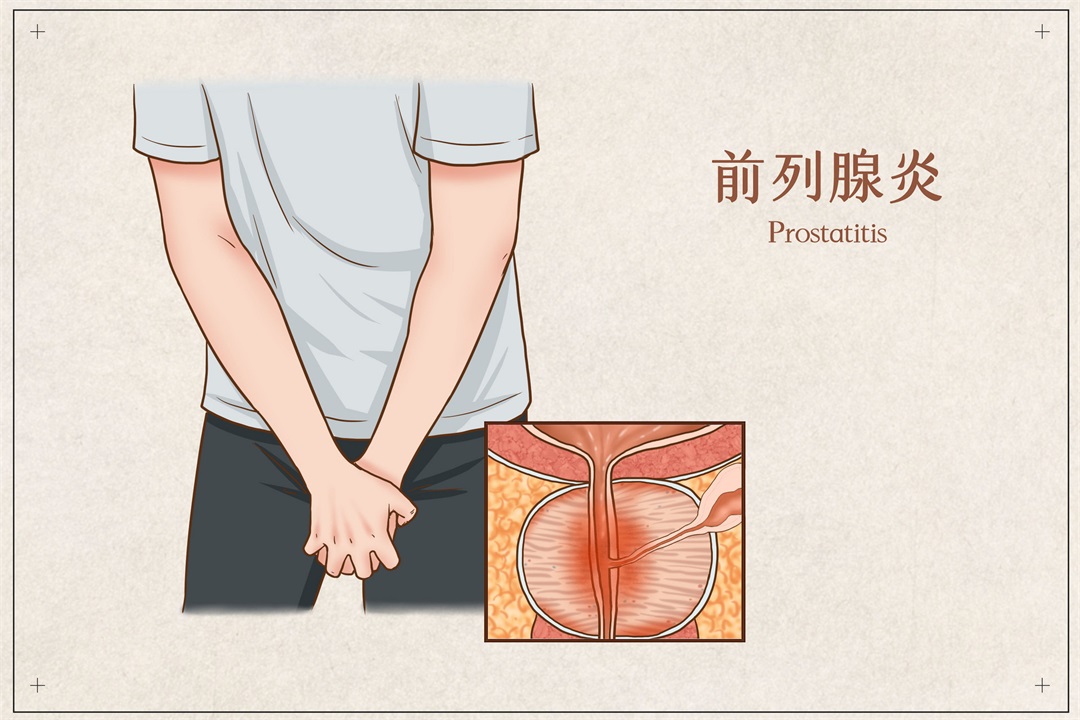 茶葉批發(fā)丨養(yǎng)生茶丨艾條的作用丨艾灸養(yǎng)生