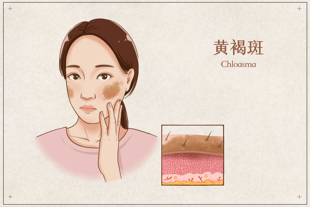 茶葉批發(fā)丨養(yǎng)生茶丨艾條的作用丨艾灸養(yǎng)生