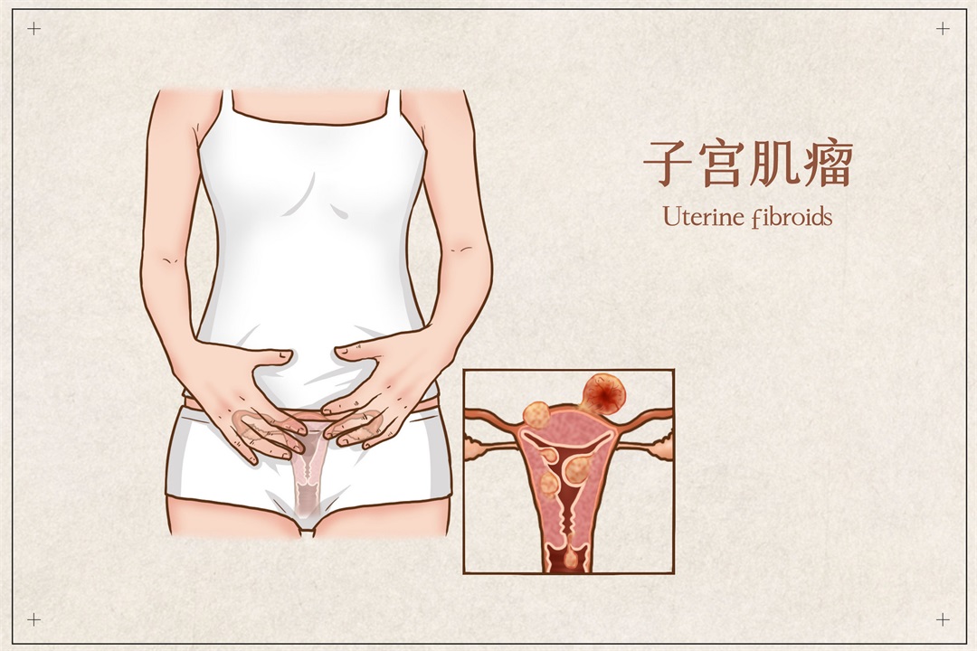 茶葉批發(fā)丨養(yǎng)生茶丨艾條的作用丨艾灸養(yǎng)生