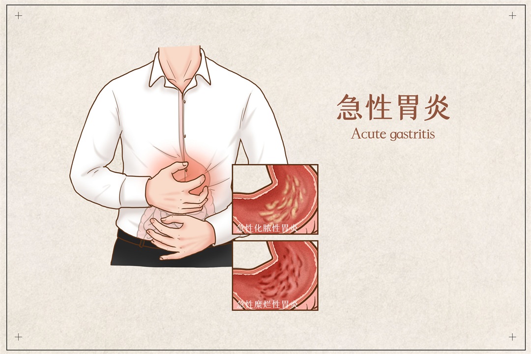 茶葉批發(fā)丨養(yǎng)生茶丨艾條的作用丨艾灸養(yǎng)生