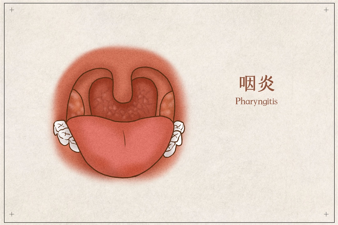 茶葉批發(fā)丨養(yǎng)生茶丨艾條的作用丨艾灸養(yǎng)生