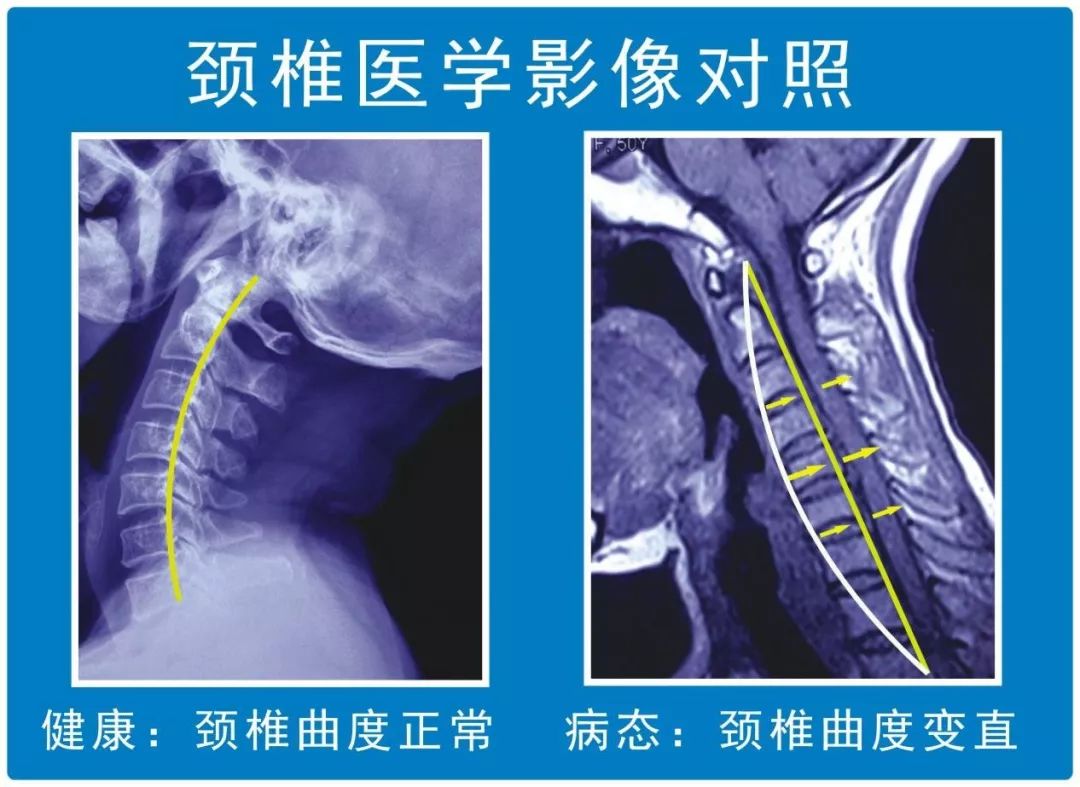 茶葉批發(fā)丨養(yǎng)生茶丨艾條的作用丨艾灸養(yǎng)生